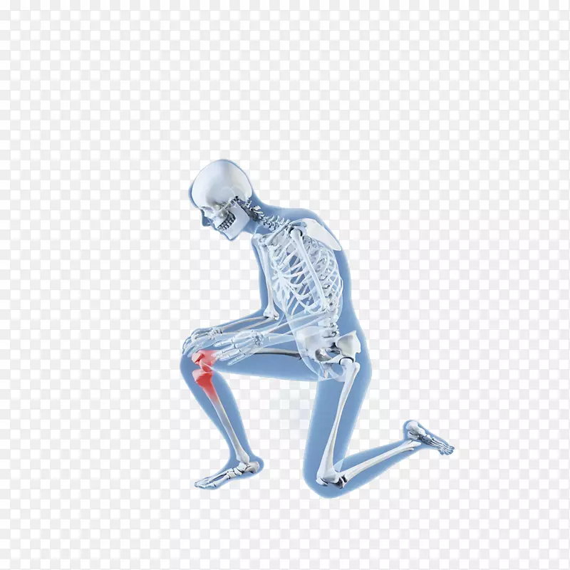 卡通腿部关节疼X光人体图素材