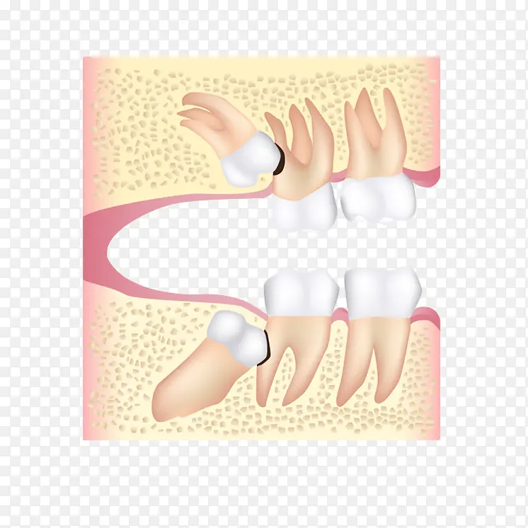 卡通立体智齿导致的牙痛插画免抠