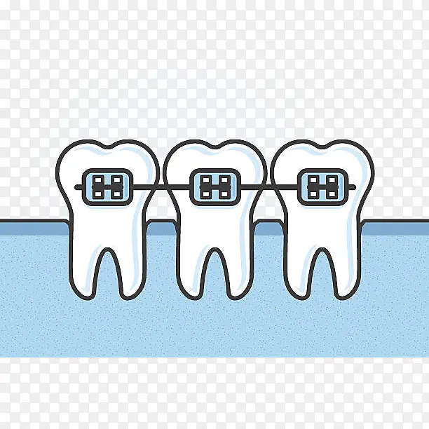 卡通三颗牙齿带牙套插画免抠