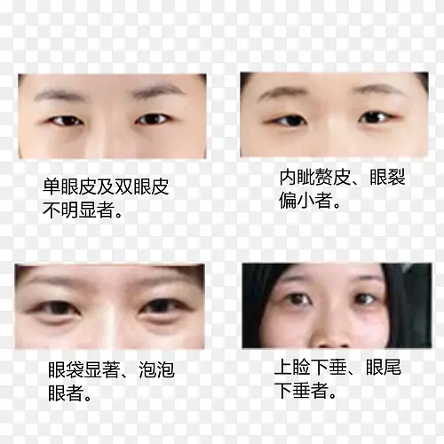 整形美容眼部实物图展示