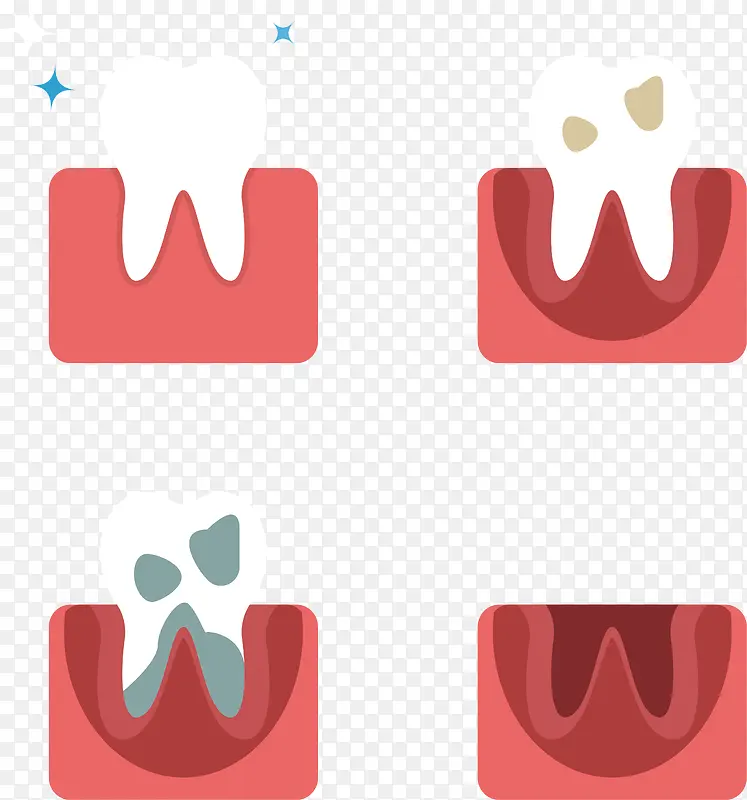 牙齿变坏过程