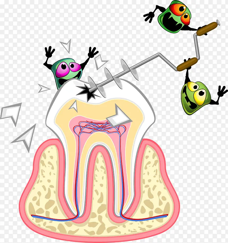 破坏牙齿的矢量细菌