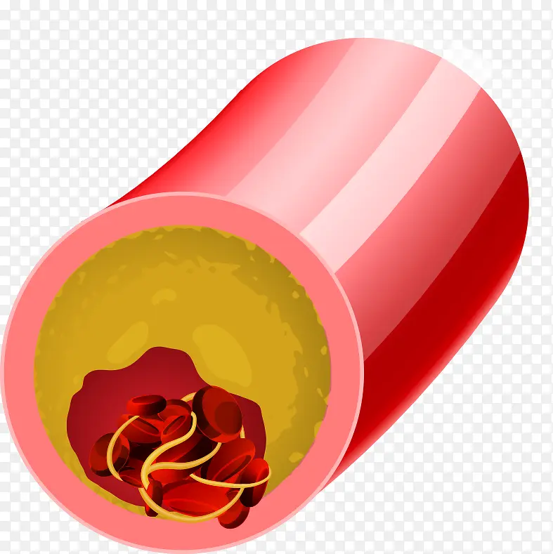 矢量血管里的红细胞