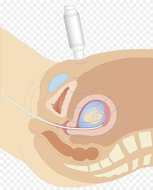 超声波胚胎探测