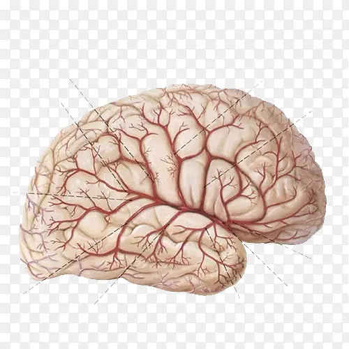 脑血管分析图