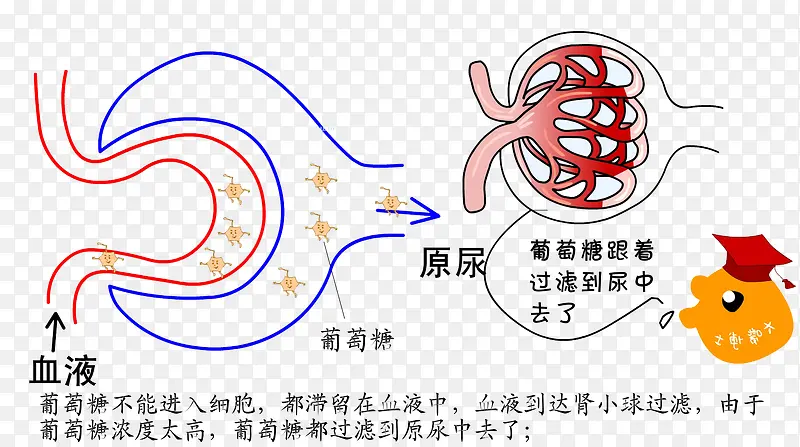 糖尿病原理