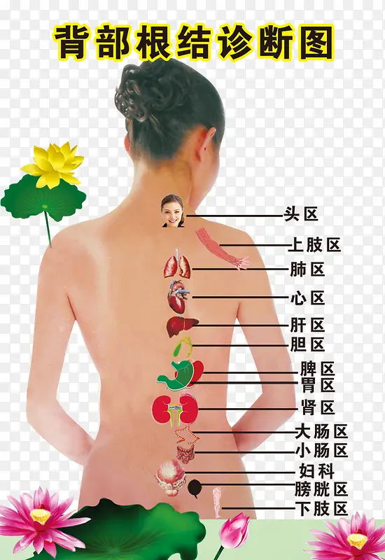 背部根结诊断图