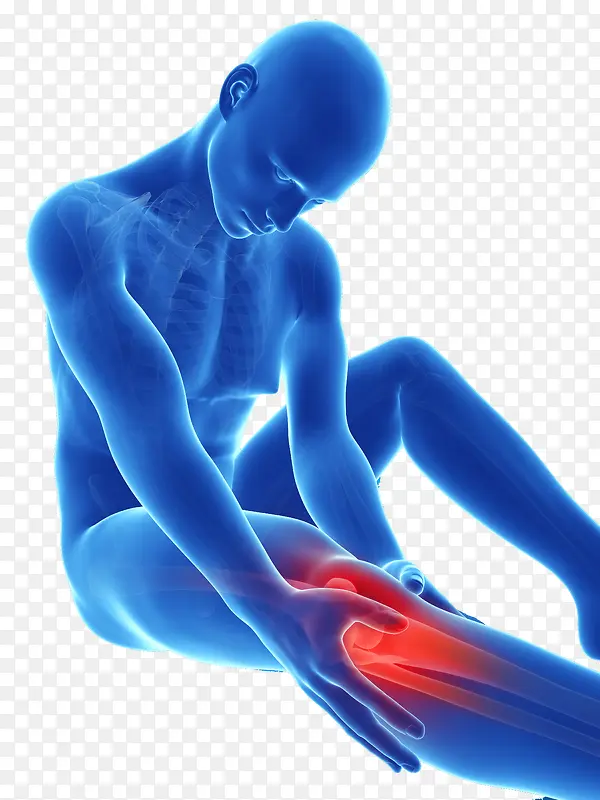 关节膝盖疼痛人物模型高清图片
