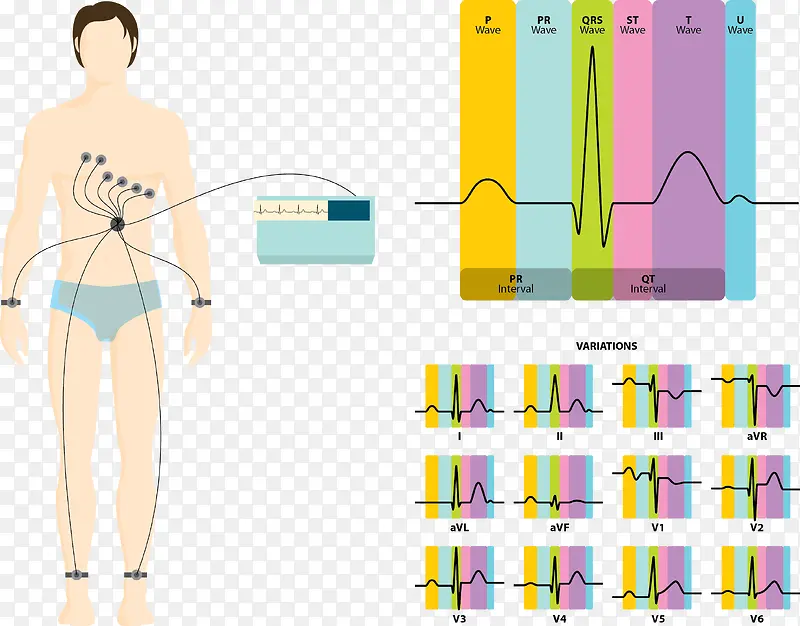 矢量图心电图