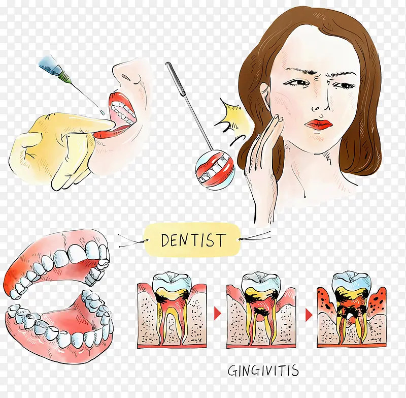 牙医手术医疗插图