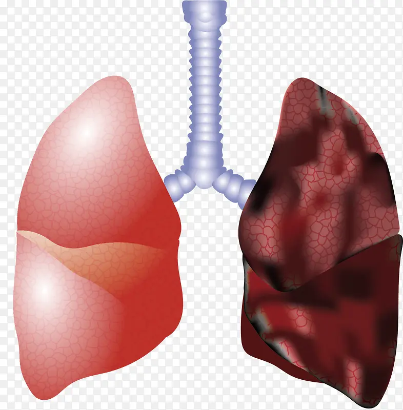 肺部矢量图