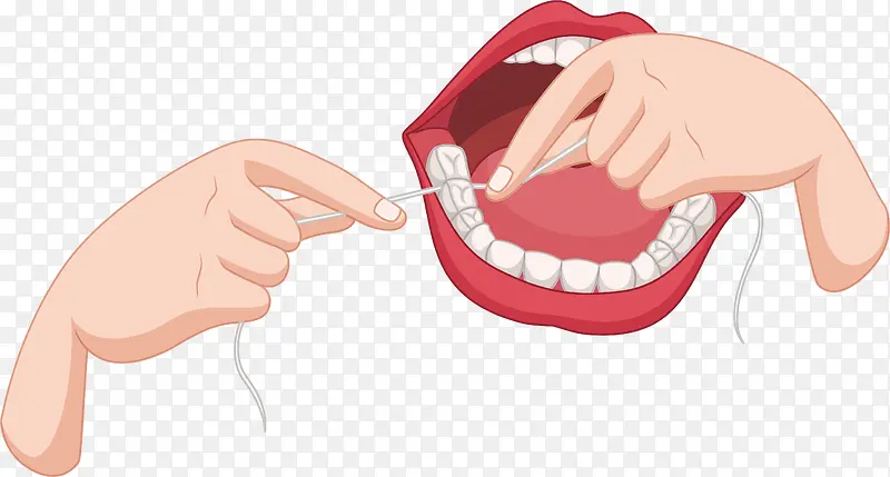牙线剔牙