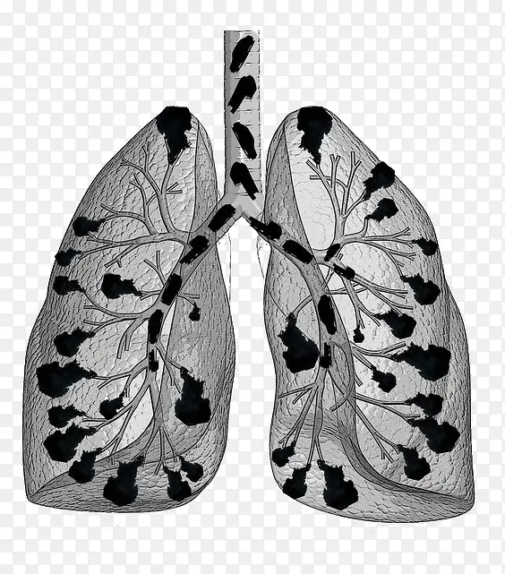 卡通吸烟肺部