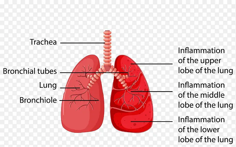 矢量肺部图