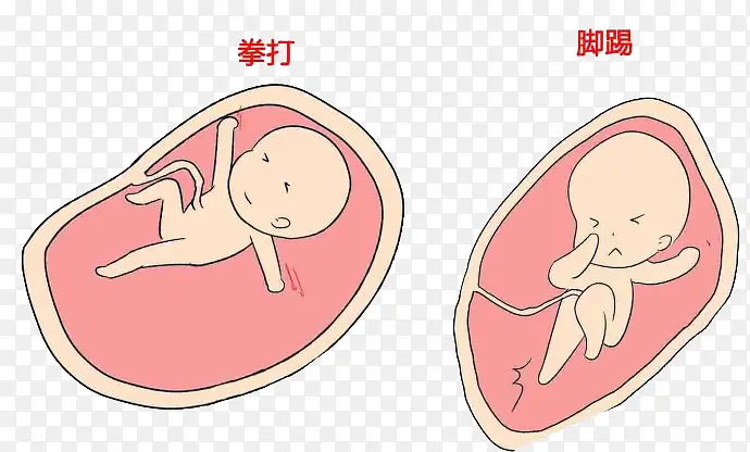 胎儿踢肚子漫画