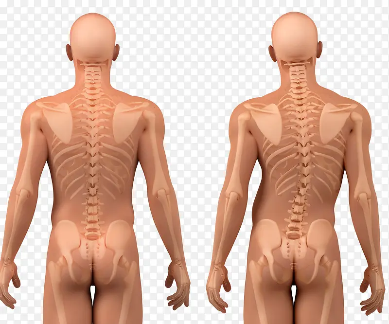 腰椎畸形对比图