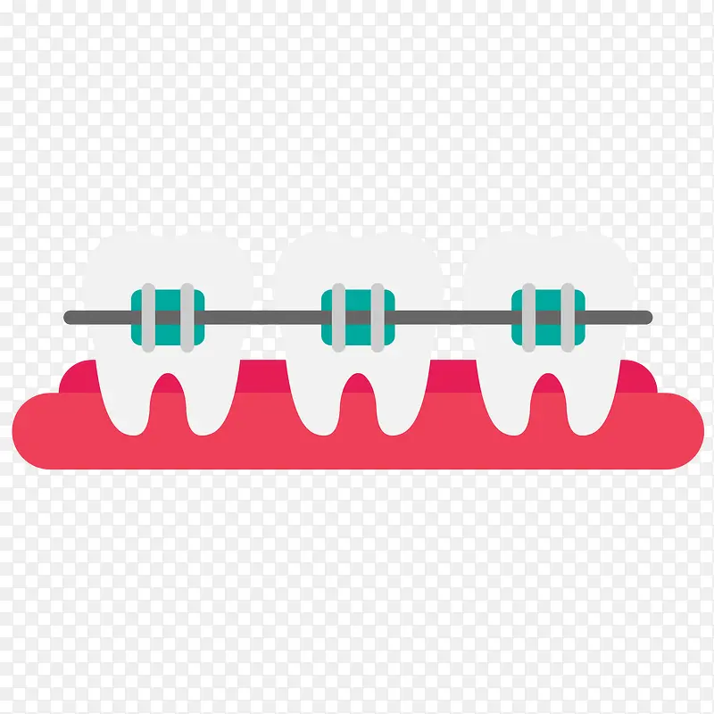 矢量口腔牙齿牙套