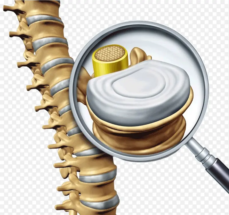 脊椎 人骨 腰椎 半月板