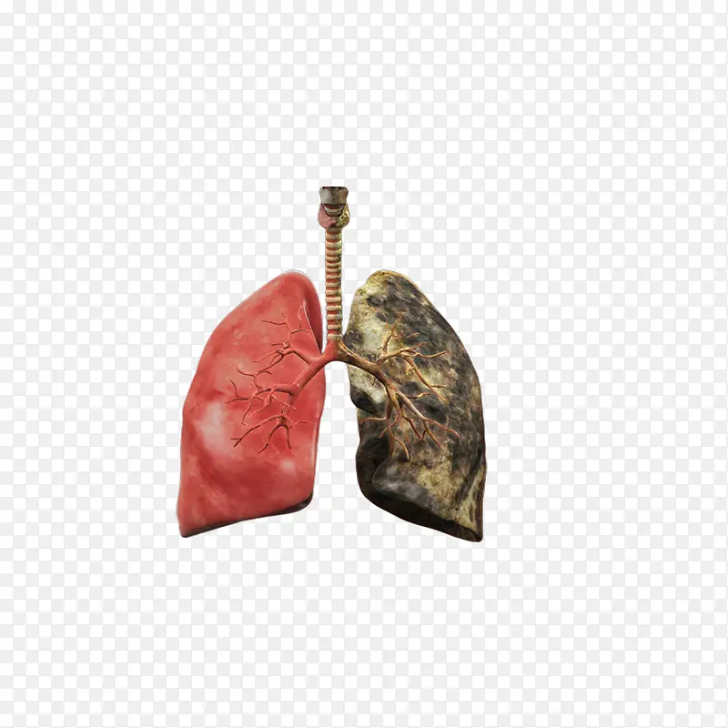 肺 肺部 人肺 吸烟者的肺